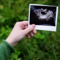 Почему на третьем месяце беременности болит живот