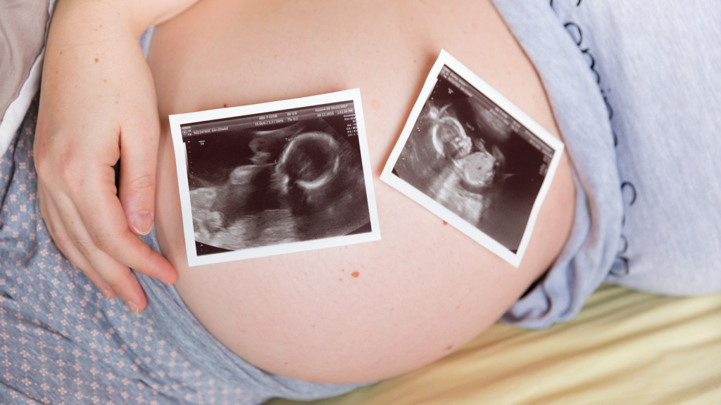 как беременеют двойней